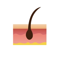 親和クリニックのMIRAI法|切らない自毛植毛で自然な若返り